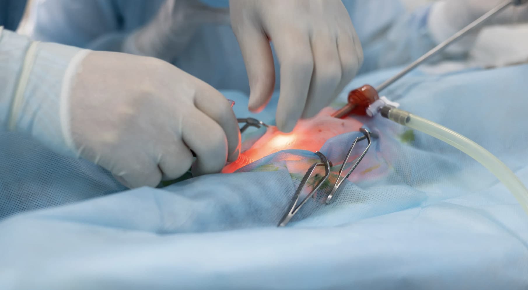 Minimally invasive spine surgery in operating room